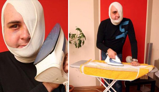 Ouch... Setrika Panas Ditempel ke Wajah karena Dikiranya Ponsel 